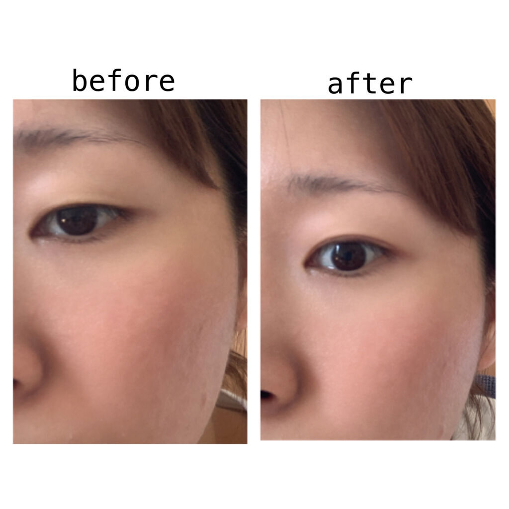 Girl's Maker ORIPUCHI＋のクチコミ「ガールズメーカー
オリプチ＋

2021年にリニューアルしたばかりのオリプチ！

皮膚を折り込.....」（3枚目）