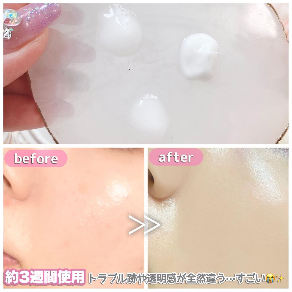 リードルショット100/VT/美容液を使ったクチコミ(9枚目)