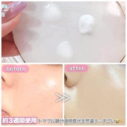 リードルショット100/VT/美容液を使ったクチコミ(9枚目)