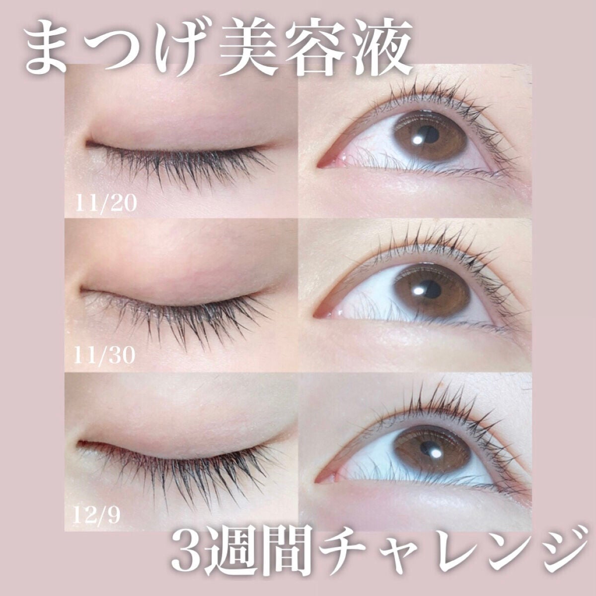 スカルプD ボーテ ピュアフリーアイラッシュセラム プレミアム/アンファー(スカルプD)/まつげ美容液を使ったクチコミ(1枚目)