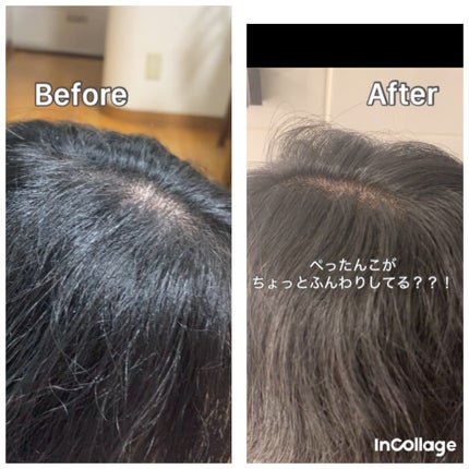 スカルプD ボーテ フワリー スカルプシャンプー/トリートメントパック/アンファー(スカルプD)/市販シャンプーを使ったクチコミ(5枚目)