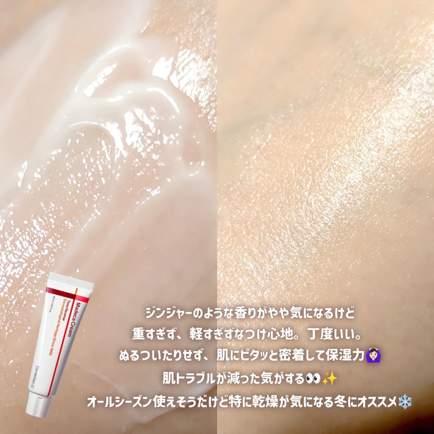 マデカクリームタイムリバース/センテリアン24/フェイスクリームを使ったクチコミ（3枚目）