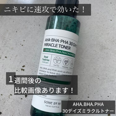 SOME BY MI AHA·BHA·PHA 30デイズミラクルトナーのクチコミ「ニキビに過去一番速攻で効いた！！！
SOME BY MI　AHA·BHA·PHA 30デイズミ.....」（1枚目）