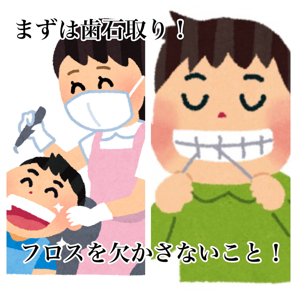 歯間ようじミントの香り付/DAISO/デンタルフロス・歯間ブラシを使ったクチコミ（3枚目）