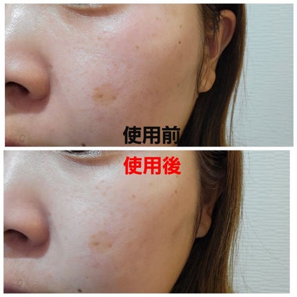 リサラット/ニカプラス/フェイスクリームを使ったクチコミ(4枚目)