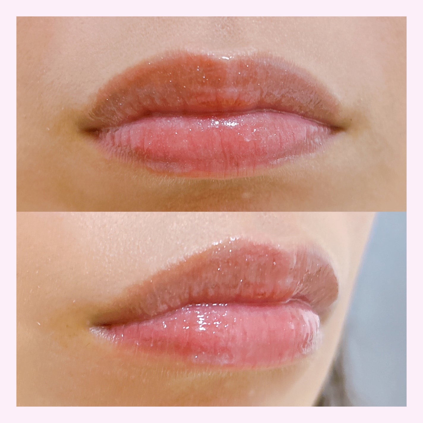 エッセンス リッププランパー/Visée/リッププランパーを使ったクチコミ(7枚目)