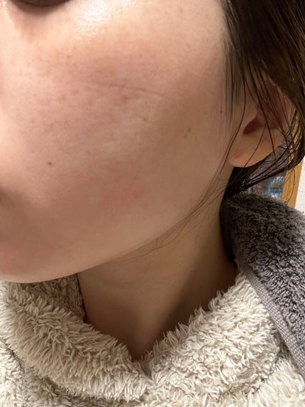 ホワイトニング ミスト セラム/アルージェ/ミスト状化粧水を使ったクチコミ(4枚目)