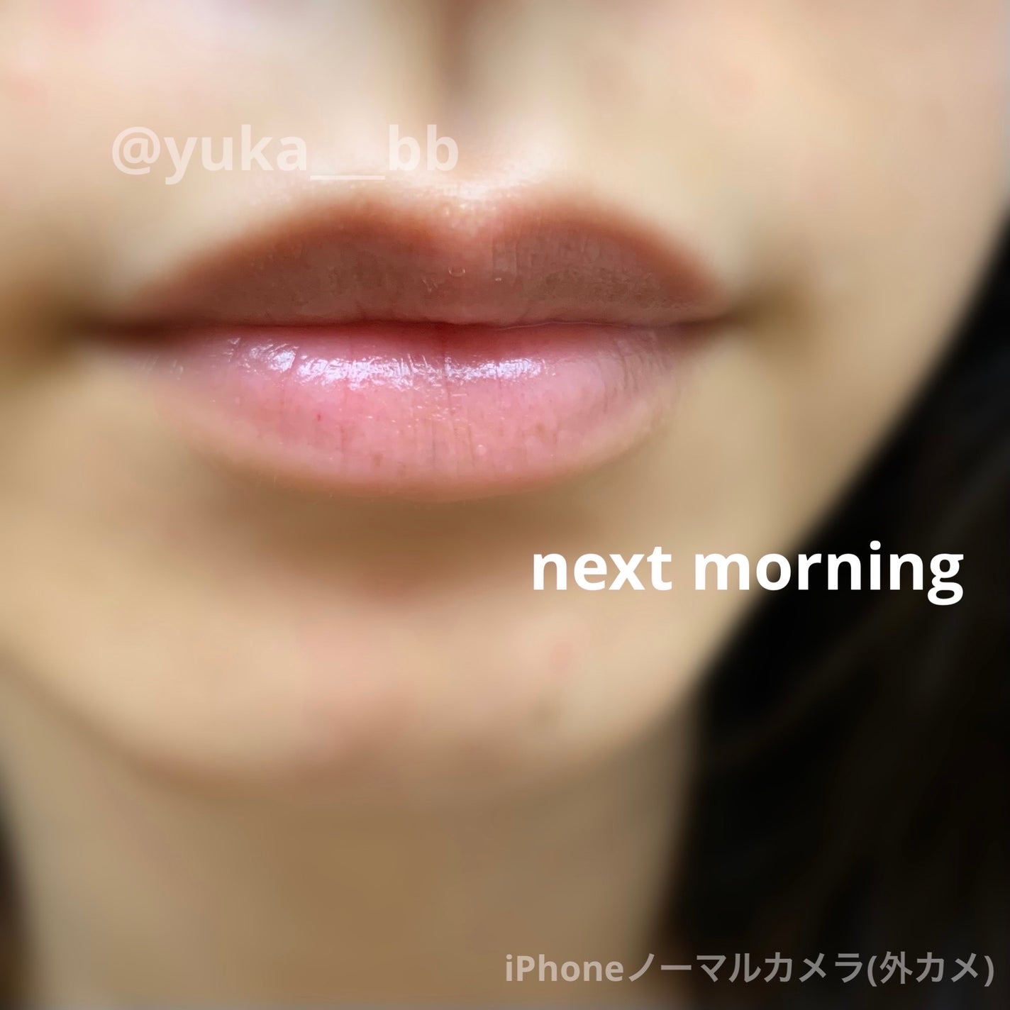 Yukað·ã€ãšãæ¥ on LIPS ãObagiãªããçŸå®¹æ¶²//æ¬æ Œçãªå¬ã«å
¥ã£ãŠåã也ç¥ããŠãŸãã..ãïŒ7æç®ïŒ