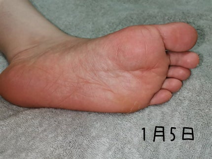 bea's up フットピーリングパック ペロリン グレープフルーツ/素数/レッグ・フットケアを使ったクチコミ(6枚目)