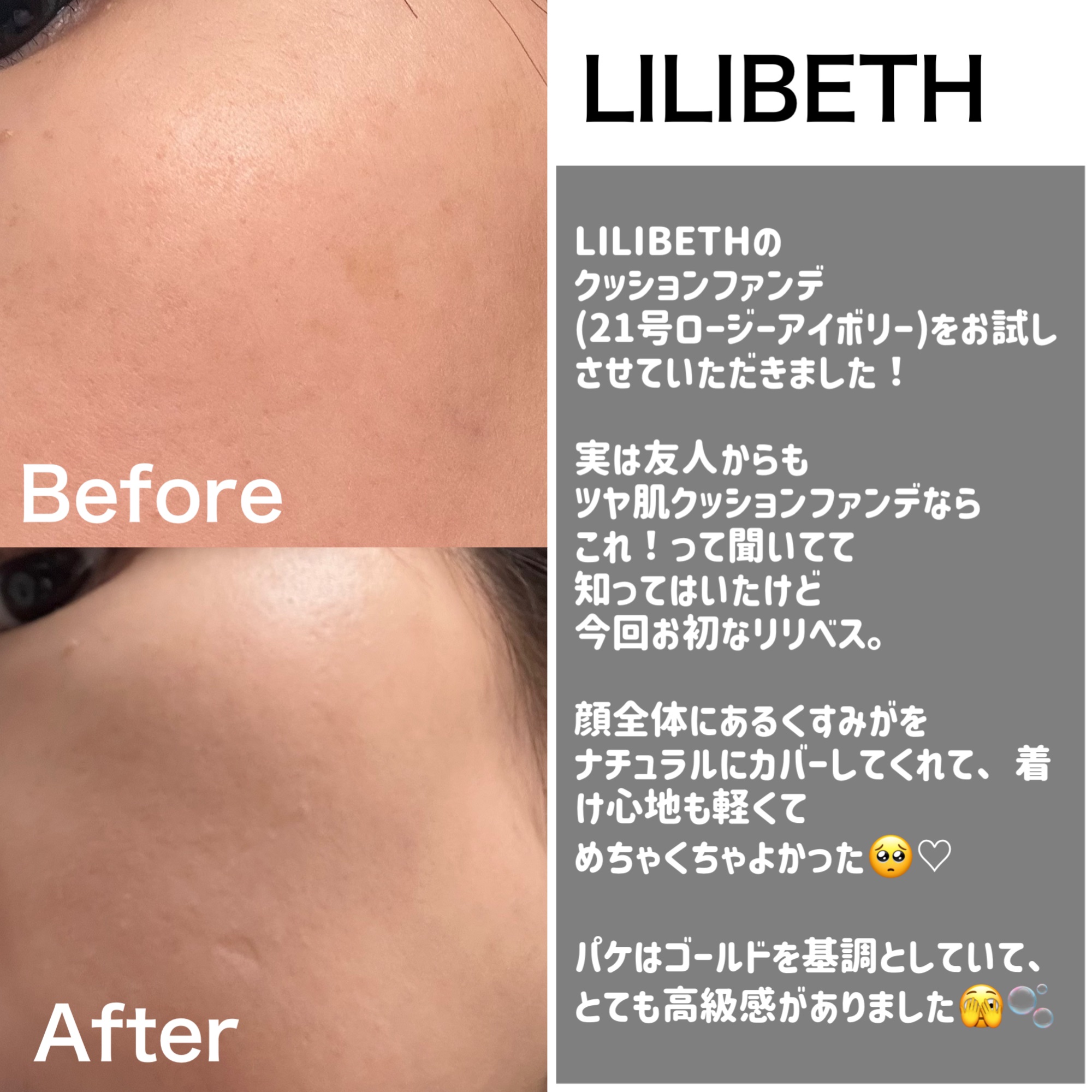 パーフェクティングフィッティング フルカバレッジクッション/LILIBETH/クッションファンデーションを使ったクチコミ（2枚目）