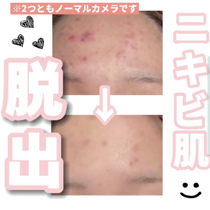 デュオ ザ クレンジングバーム ブラック/DUO/クレンジングバームを使ったクチコミ(1枚目)