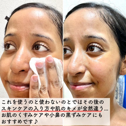 AHA·BHA·PHA 30デイズミラクルトナー/SOME BY MI/化粧水を使ったクチコミ(4枚目)