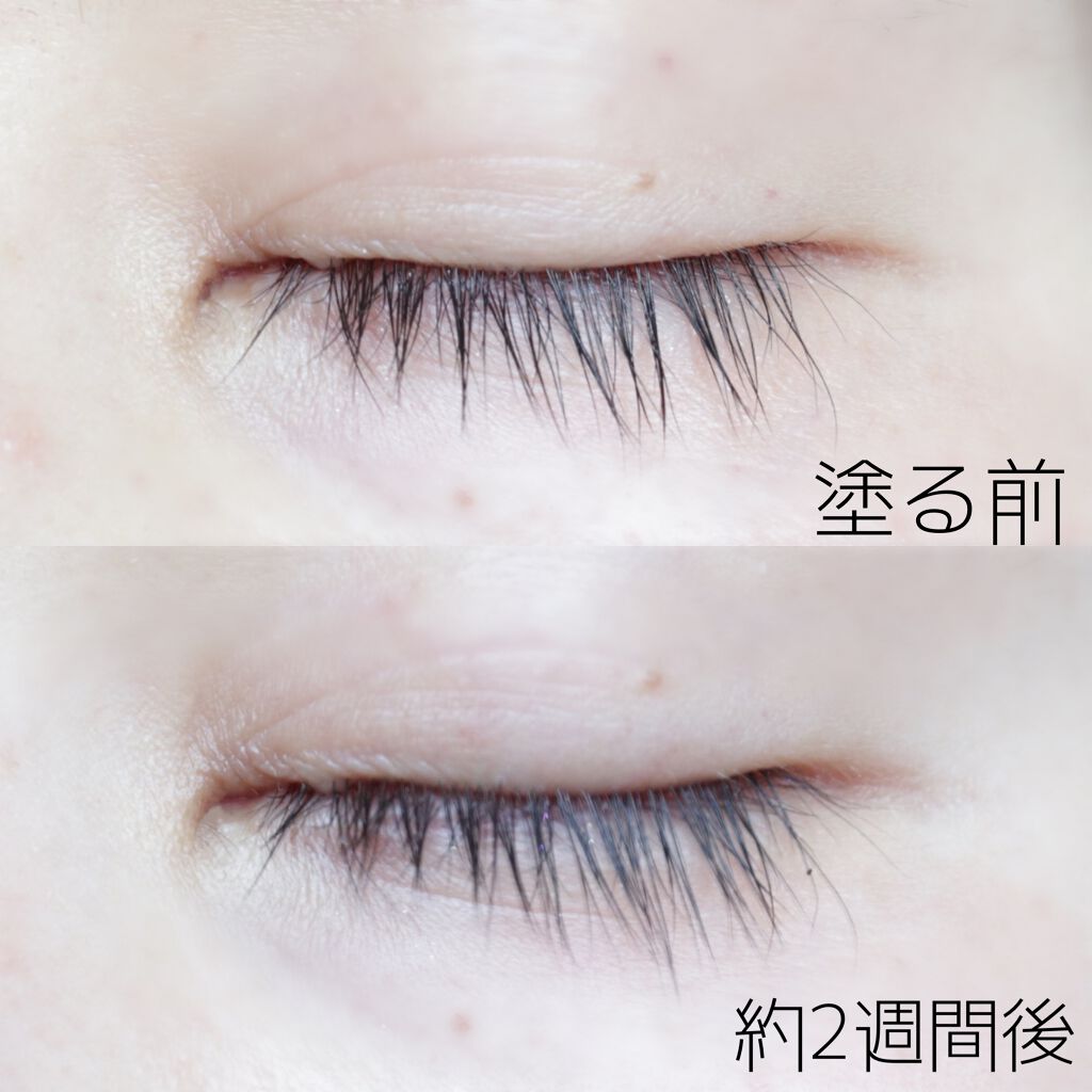 アイラッシュセラム/SEIMEI/まつげ美容液を使ったクチコミ（3枚目）