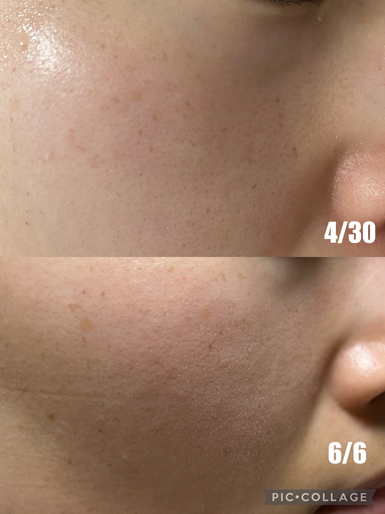 5番 白玉グルタチオンC美容液/numbuzin/美容液を使ったクチコミ(4枚目)