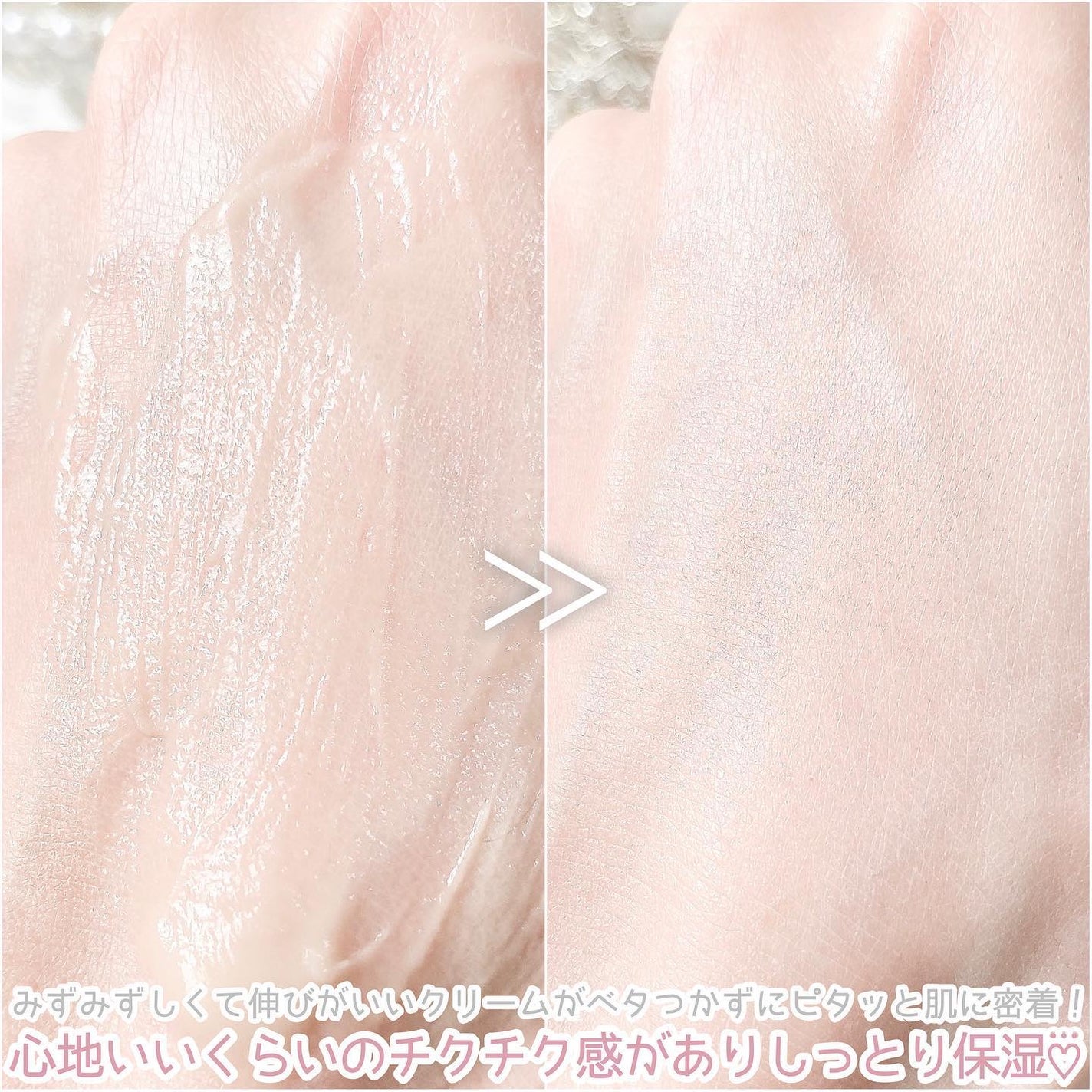 ナノ ニードル 1200 リフティングクリーム/VELY VELY/フェイスクリームを使ったクチコミ(5枚目)