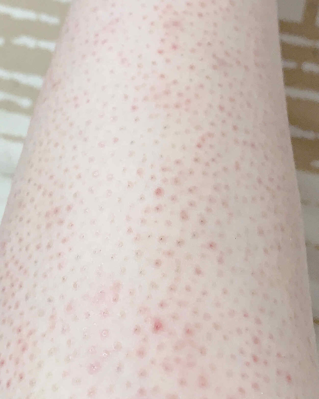 キップパイロール-Hi（医薬品）/佐藤製薬/その他を使ったクチコミ（2枚目）