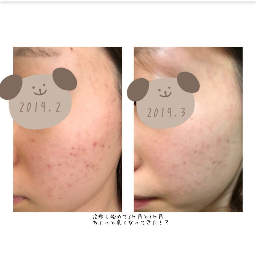 ザ・タイムR アクア/IPSA/化粧水を使ったクチコミ(4枚目)