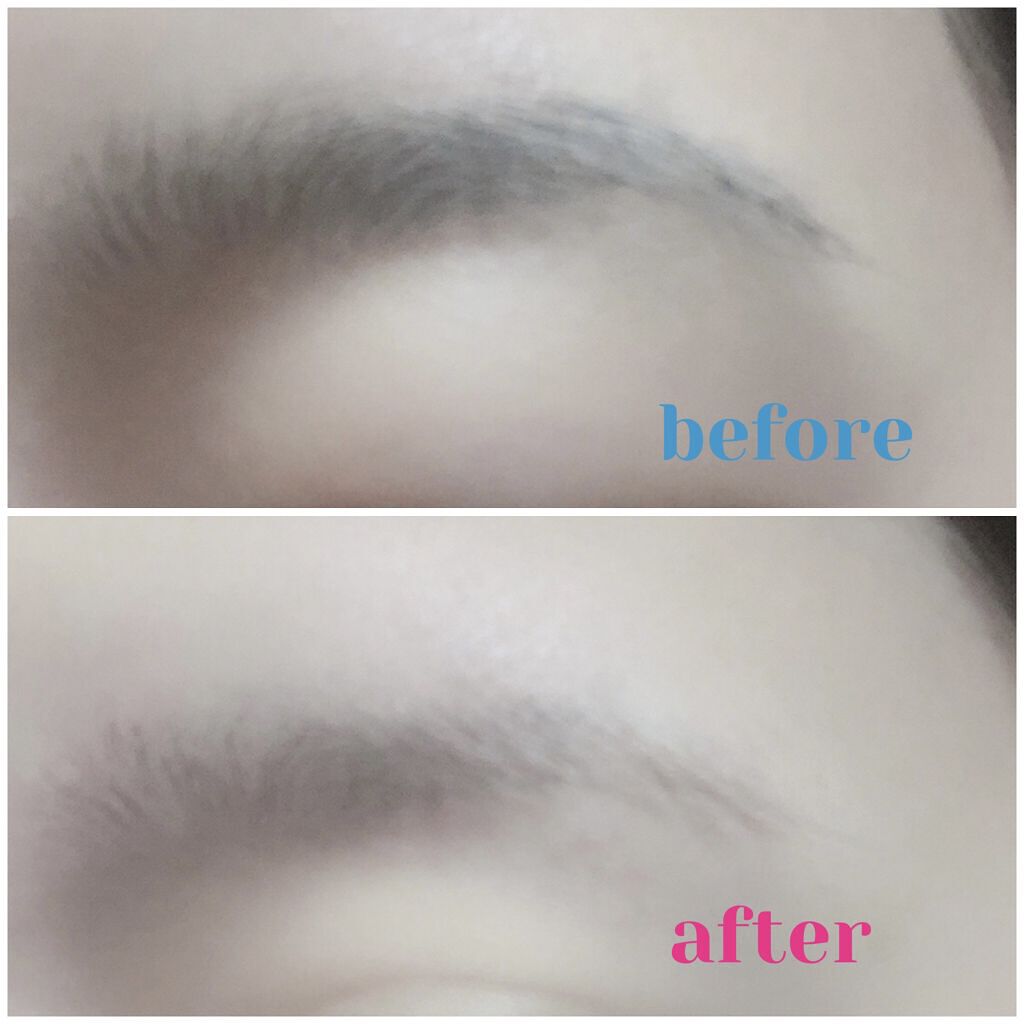 脱色クリーム スピーディー/エピラット/ムダ毛ケアを使ったクチコミ（3枚目）