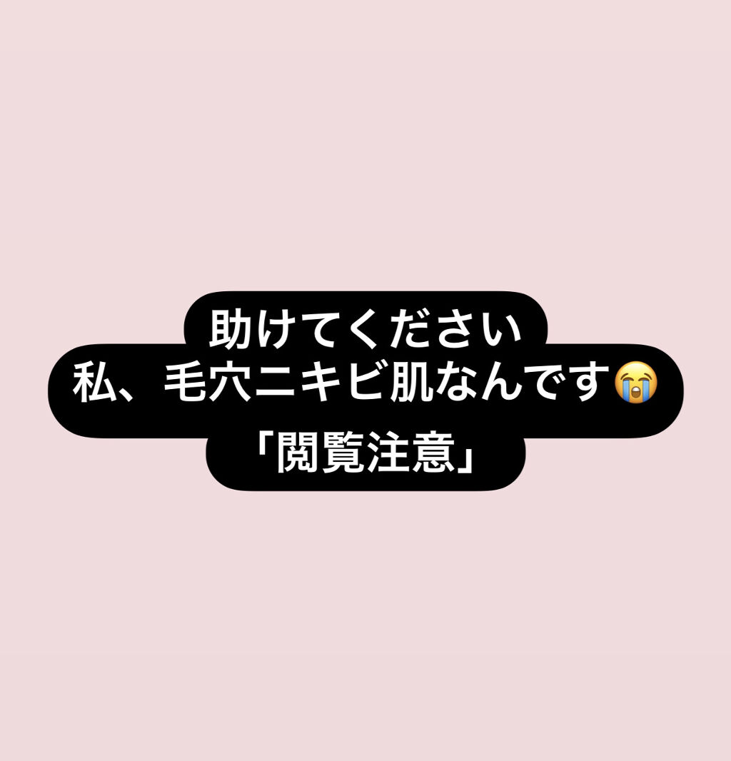 ペアアクネクリームW(医薬品)/ペア/その他を使ったクチコミ（1枚目）