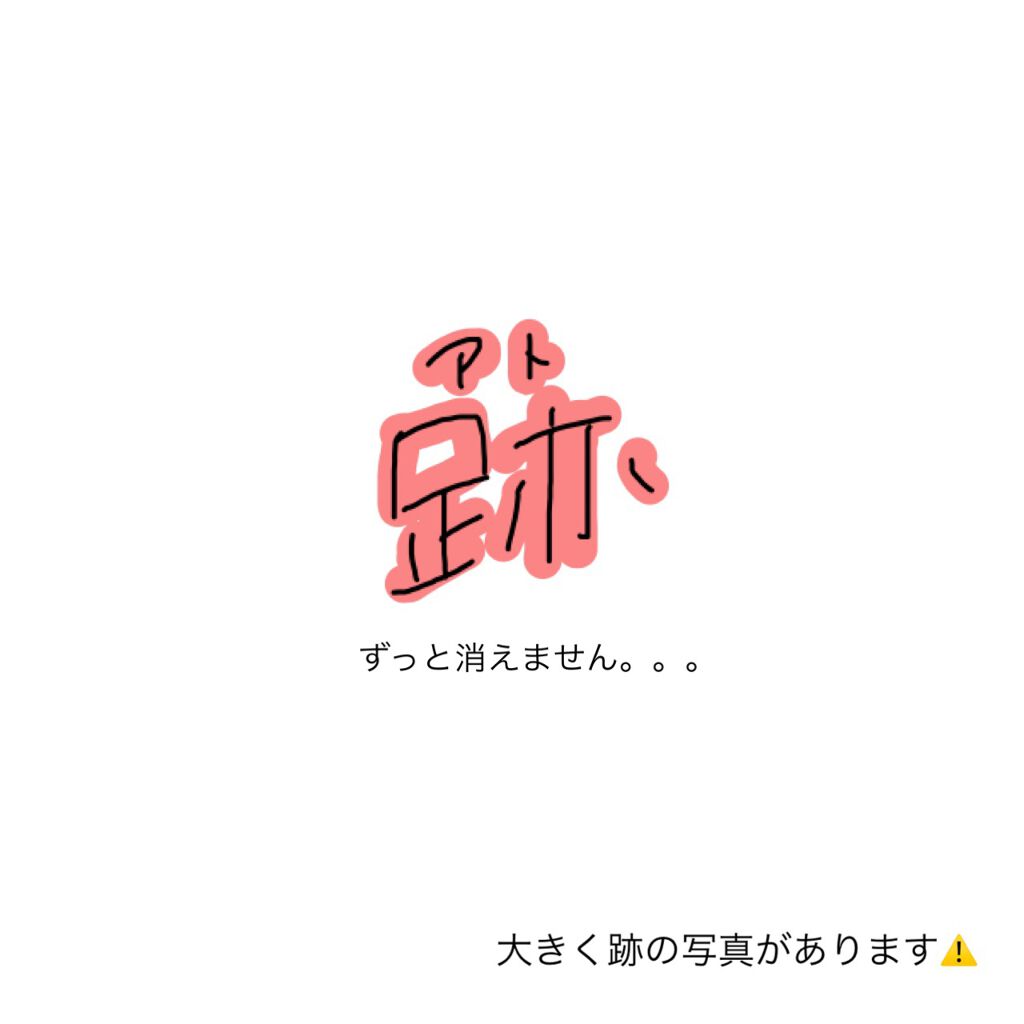 プリスクリードD(医薬品)/IHADA/その他を使ったクチコミ（1枚目）