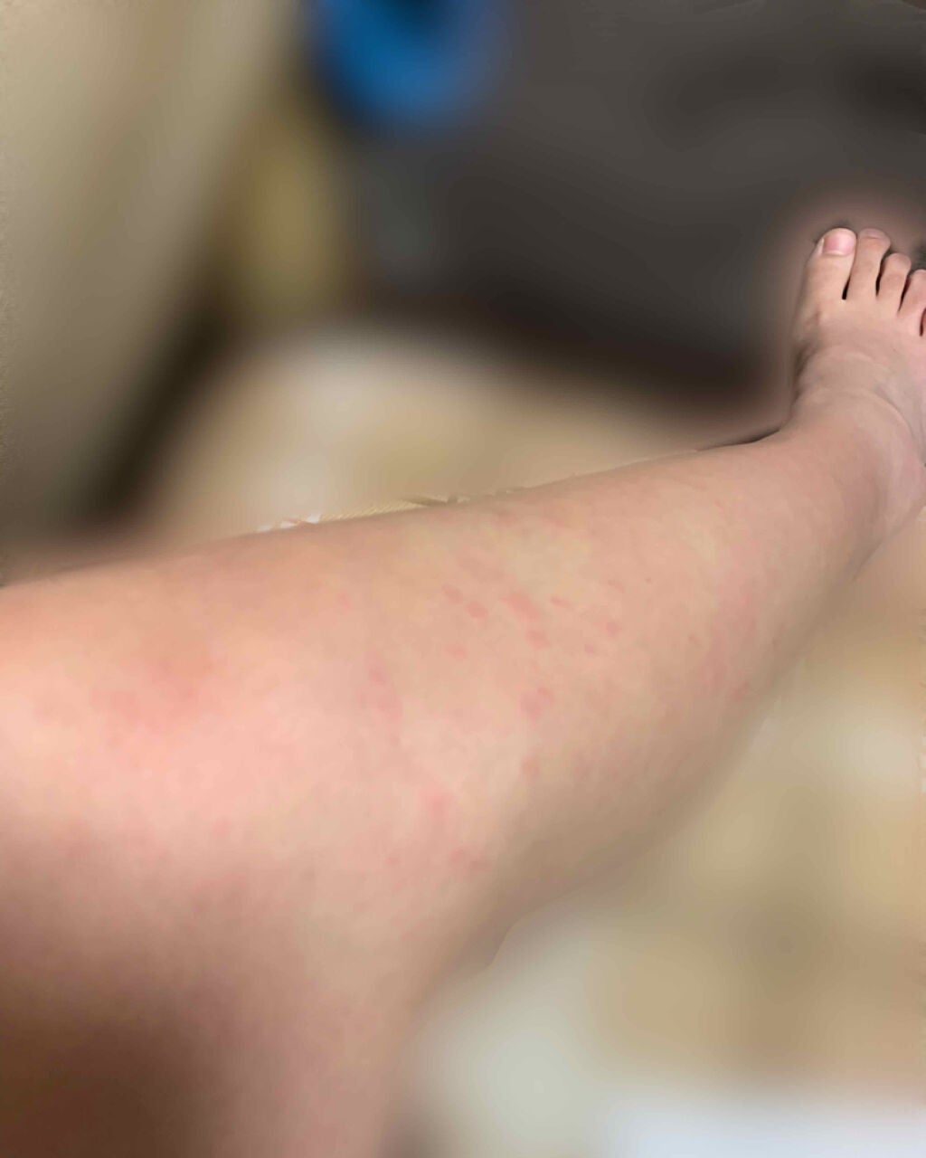 イントゥイション 敏感肌用 ホルダー (刃付き)+替刃1コ/イントゥイション/シェーバーを使ったクチコミ(2枚目)