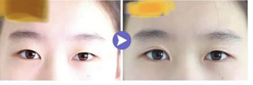 アンジュリックダブル/NATURA BLANC/二重まぶた用アイテムを使ったクチコミ（1枚目）