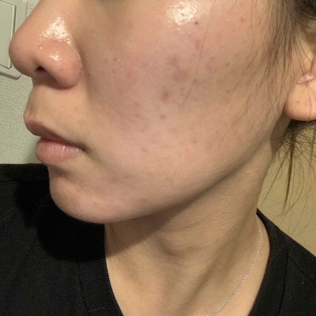 ゆる子 on LIPS 「..」(2枚目)