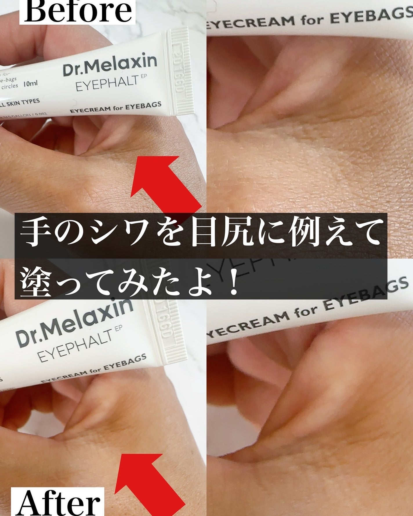 アイファルトアイバッククリーム/Dr.Melaxin/アイケア・アイクリームを使ったクチコミ(7枚目)
