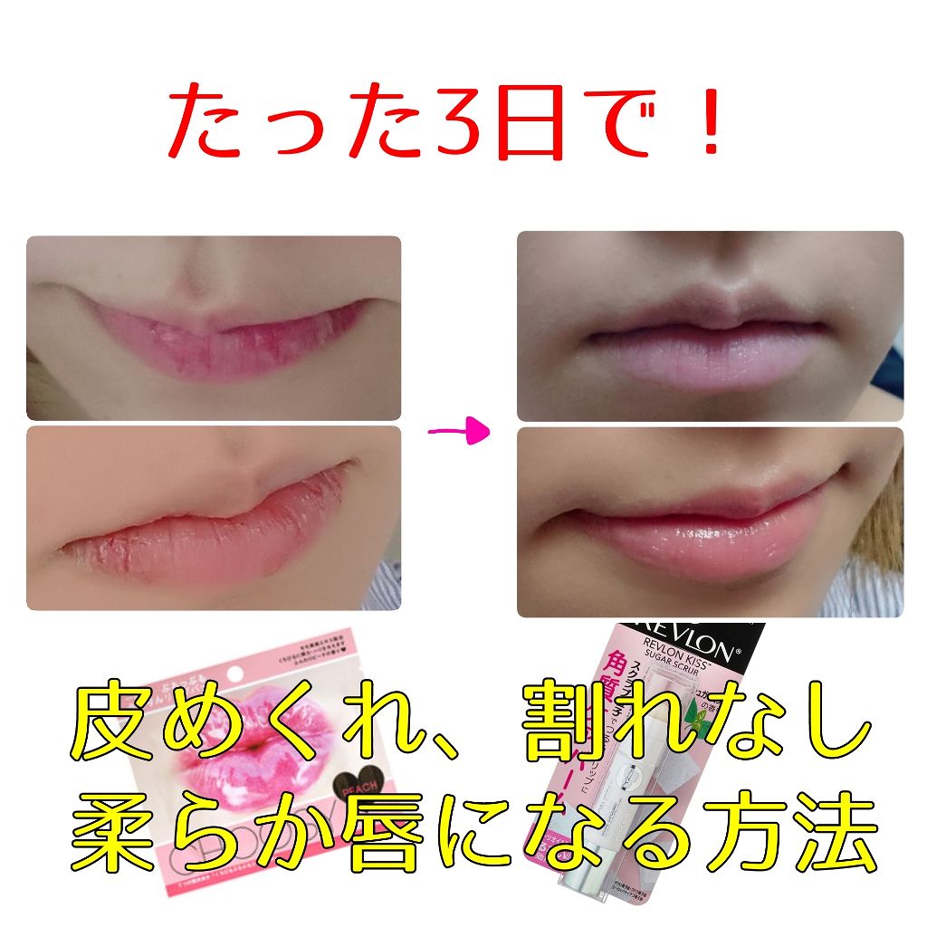 リップパック /CHOOSY/リップマスクを使ったクチコミ(1枚目)