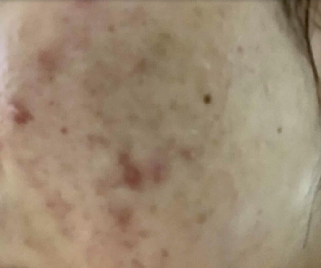 ミノン アミノモイスト モイストチャージ ミルク/ミノン/乳液を使ったクチコミ（2枚目）