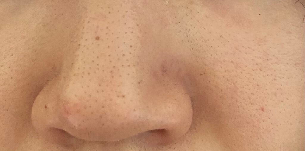 オバジC 酵素洗顔パウダー/オバジ/洗顔パウダーを使ったクチコミ(2枚目)