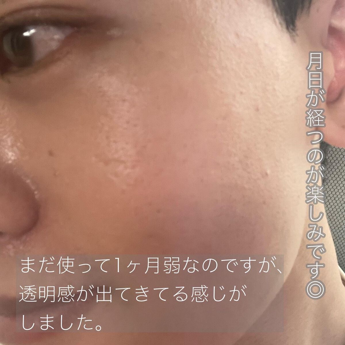 ダーマエアショット/MEDICUBE/美顔器・マッサージを使ったクチコミ(4枚目)