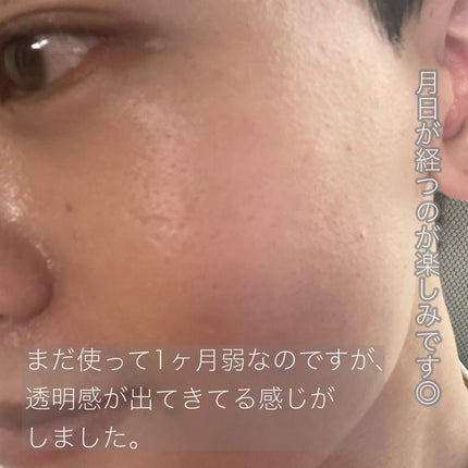 ダーマエアショット/MEDICUBE/美顔器・マッサージを使ったクチコミ(4枚目)