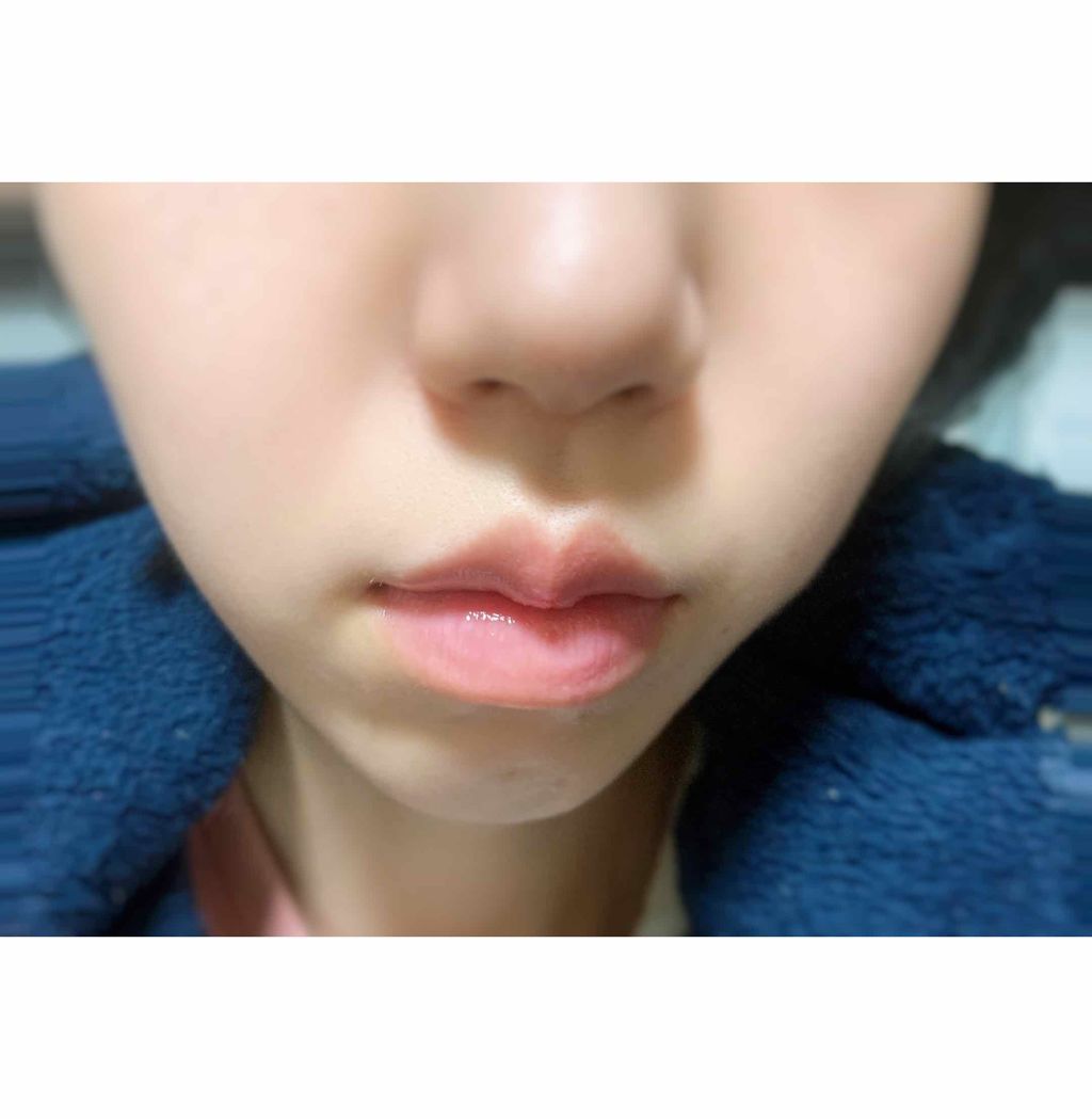 リップエッセンス（ホット）a PK/ettusais/リップケアを使ったクチコミ（2枚目）