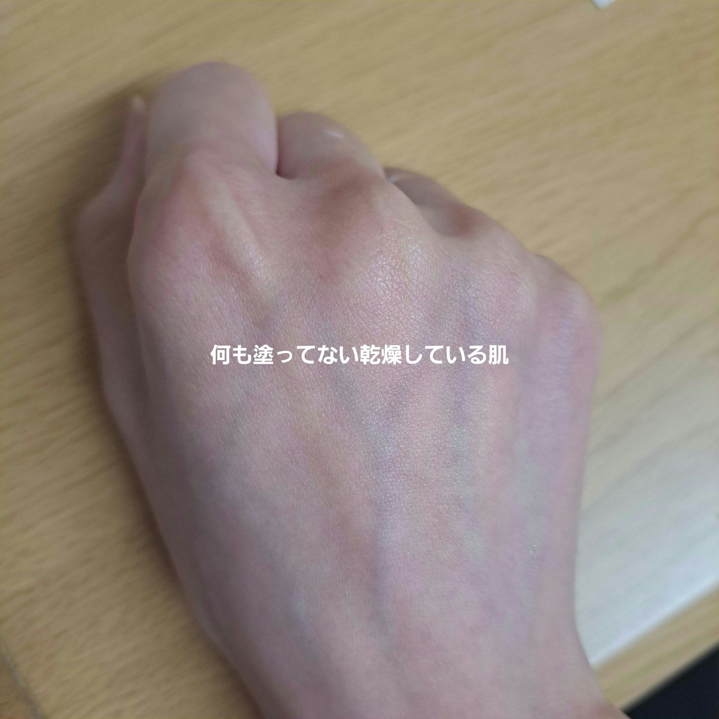 ライス70 グロウミルキートナー/Anua/化粧水を使ったクチコミ(9枚目)