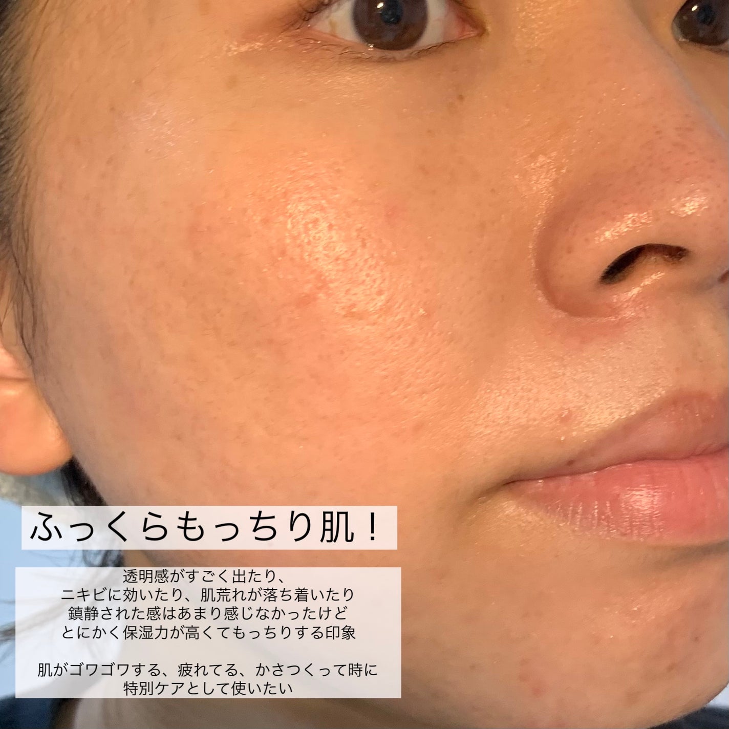 プラセンタ リバイタルエッセンシャルマスクEX/MEDIHEAL/シートマスク・パックを使ったクチコミ(7枚目)