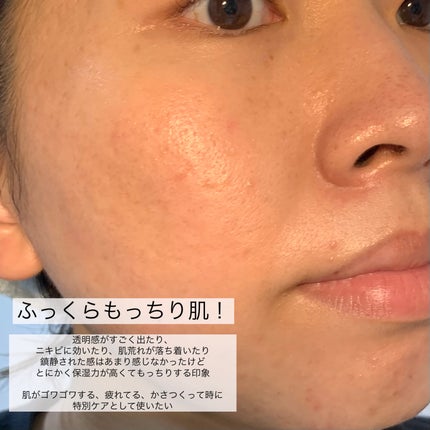 プラセンタ リバイタルエッセンシャルマスクEX/MEDIHEAL/シートマスク・パックを使ったクチコミ(7枚目)