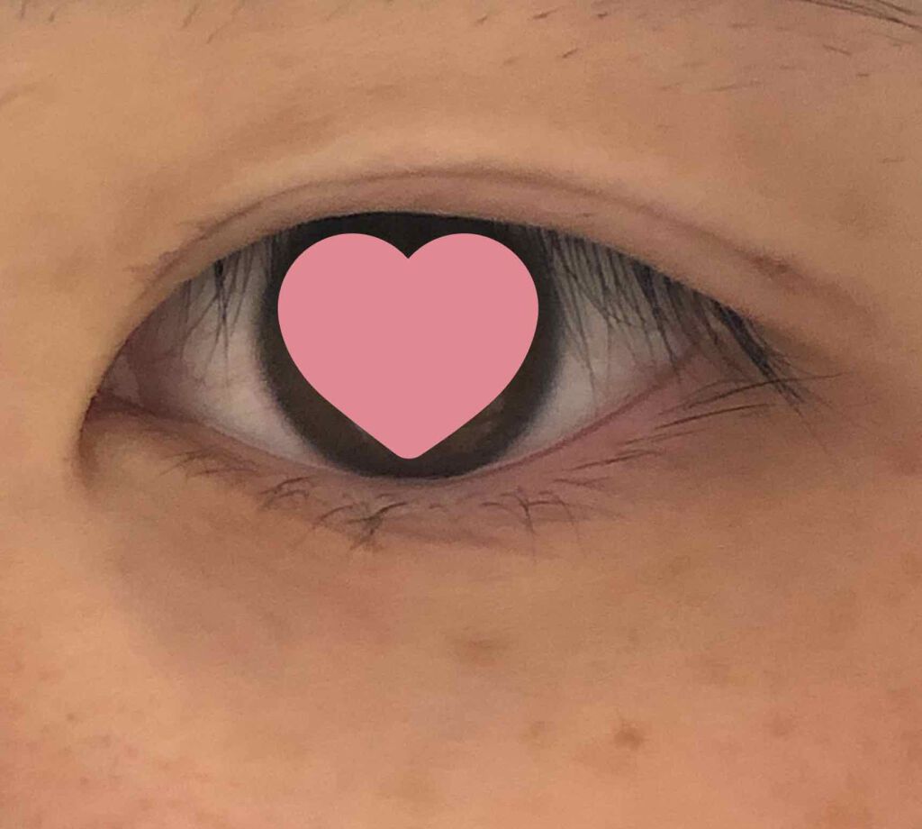 アイビューティー フィクサー WP/アストレア ヴィルゴ/二重まぶた用アイテムを使ったクチコミ(2枚目)