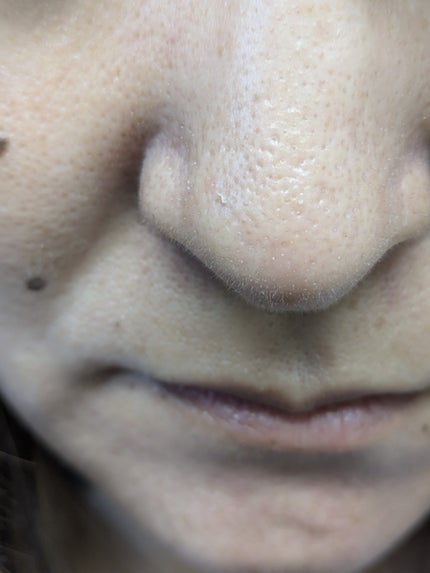 ブラックスネイルレチノールセラム/Dr.G/美容液を使ったクチコミ(2枚目)