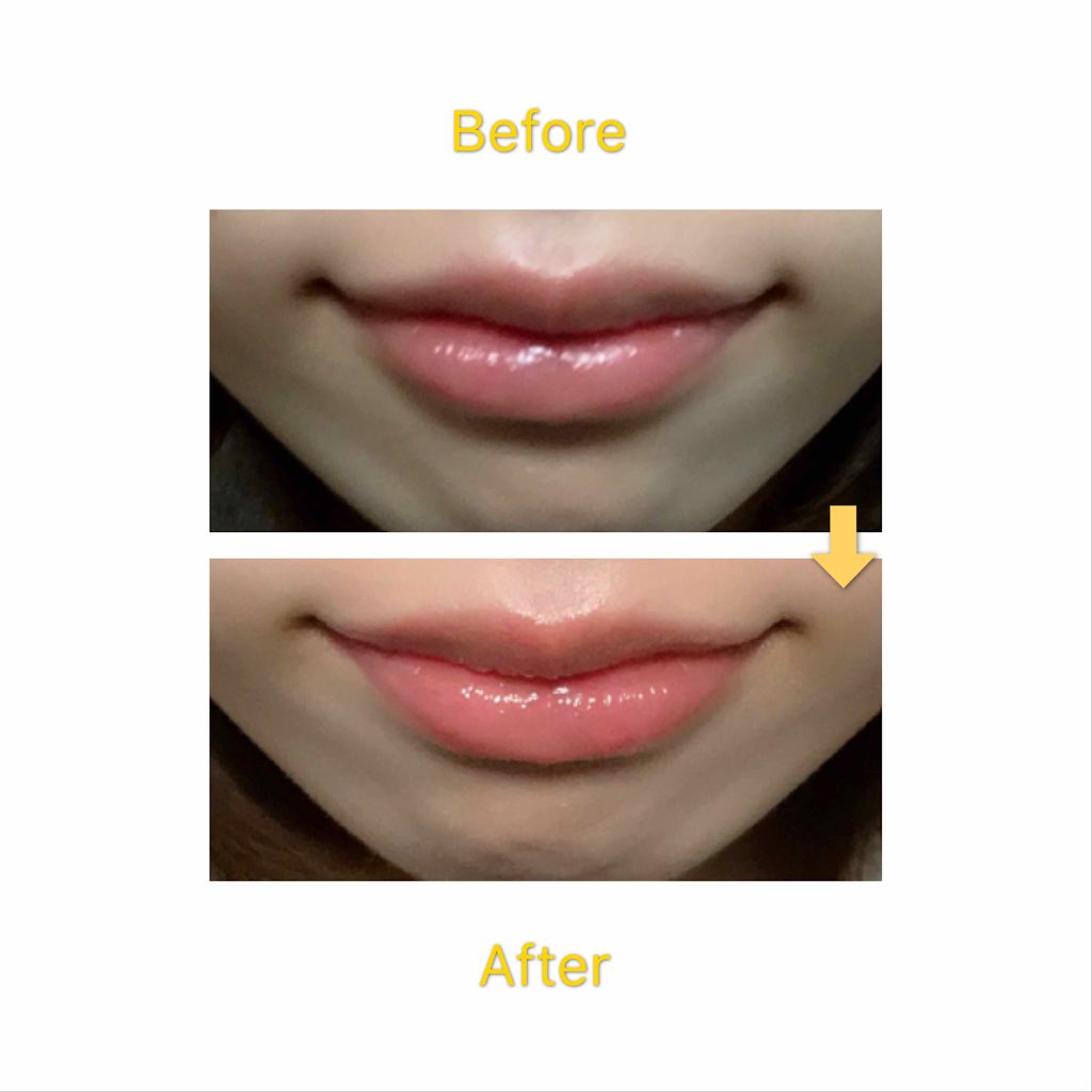 オイルティントリップ コーラル/CandyDoll/リップティントを使ったクチコミ（2枚目）