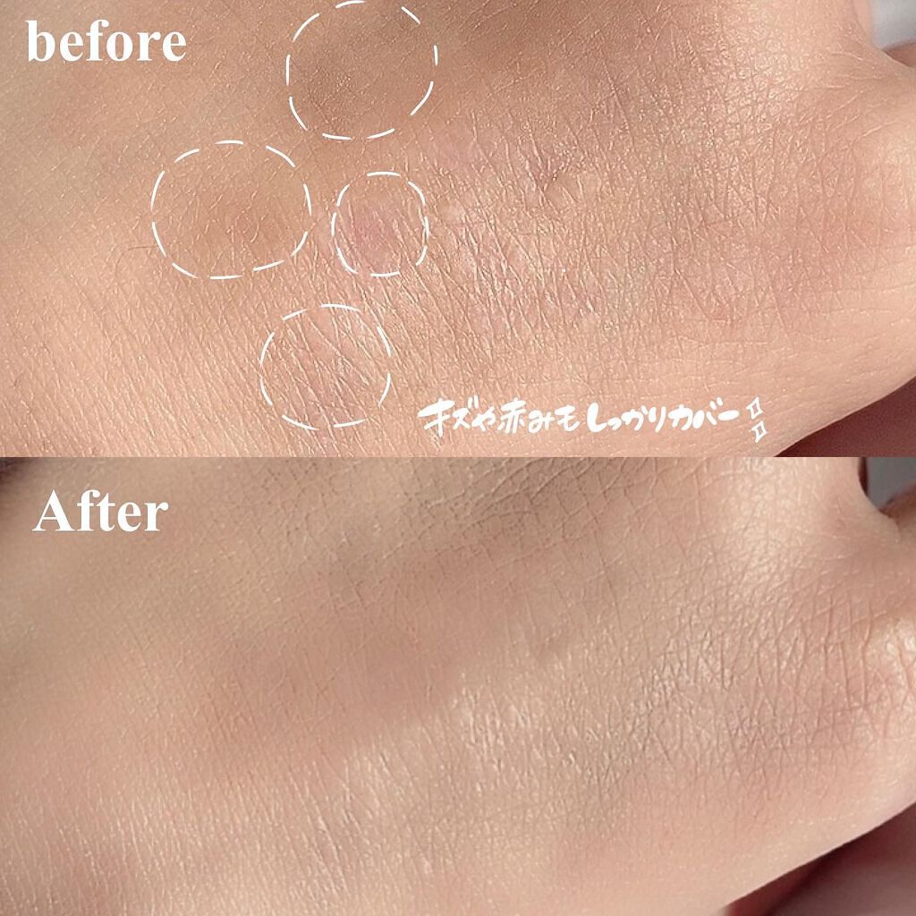 【旧】ディオールスキン フォーエヴァー スキン コレクト コンシーラー/Dior/リキッドコンシーラーを使ったクチコミ（3枚目）