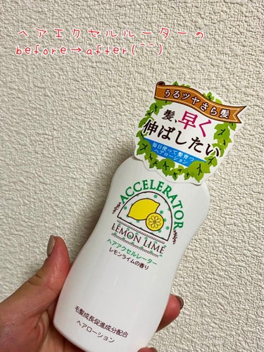 きみばな on LIPS 「ヘアアクセルルーターのビフォーアフター！髪が早く伸びるというア..」（1枚目）