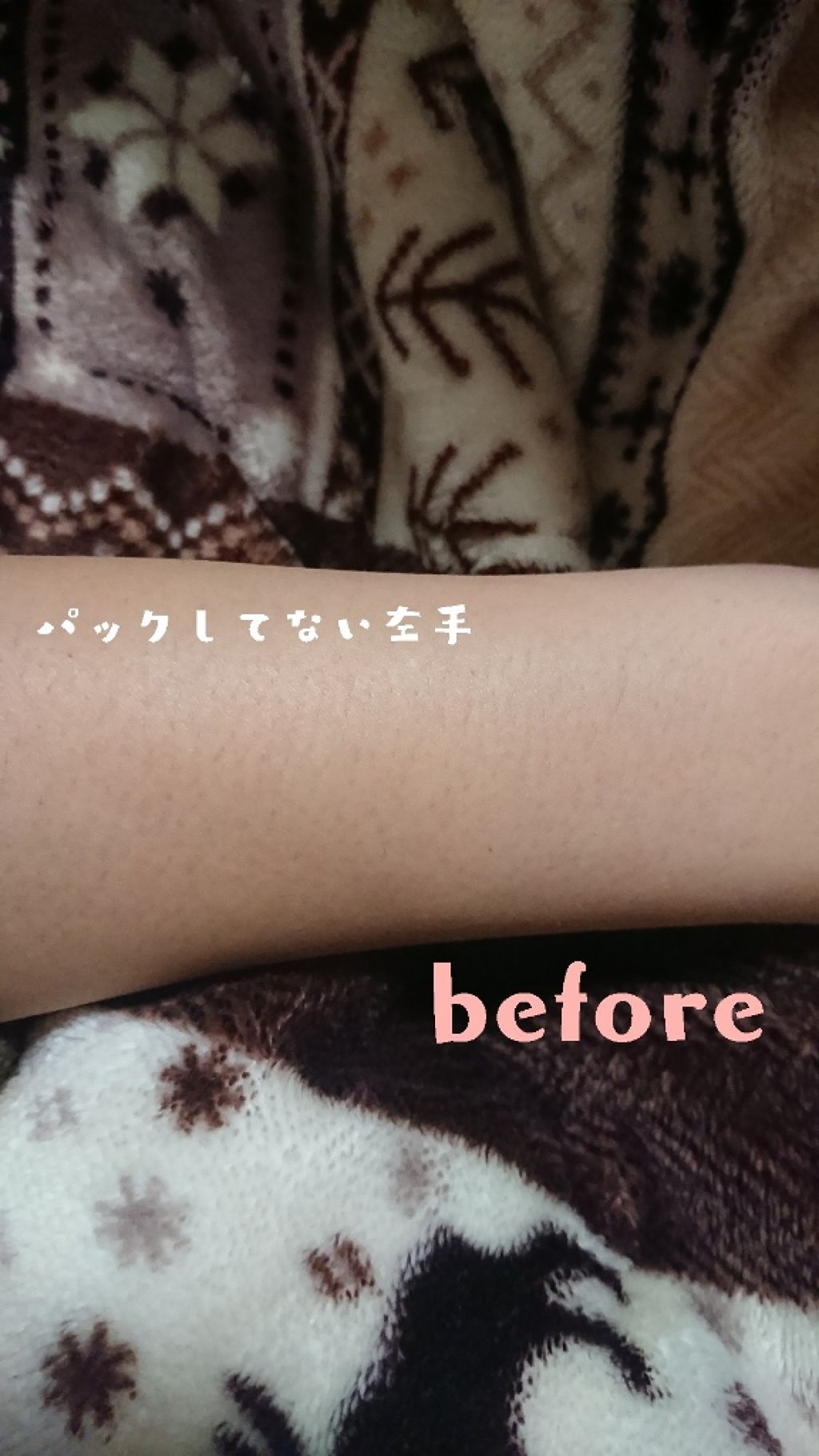 薬用ホワイトパックN/透明白肌/洗い流すパック・マスクを使ったクチコミ(2枚目)