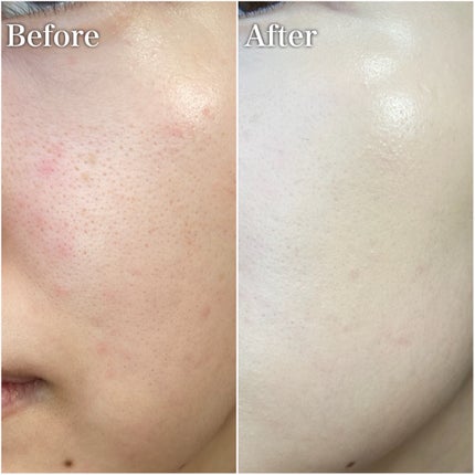 F5 リフレッシュクッション/keybo/クッションファンデーションを使ったクチコミ(5枚目)