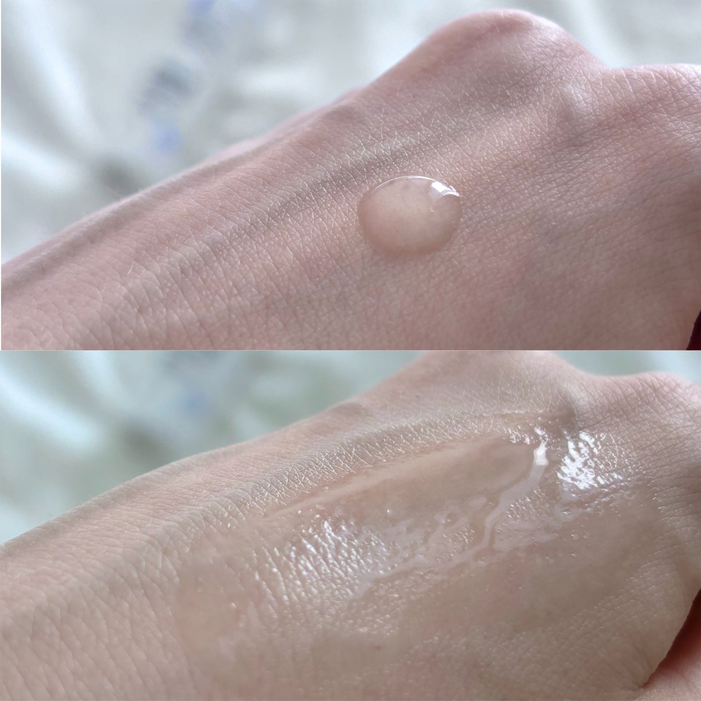 リードルショット300/VT/美容液を使ったクチコミ(8枚目)