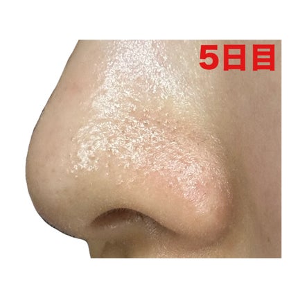 3番 緑茶炭毛穴パッククレンジングバーム/numbuzin/クレンジングバームを使ったクチコミ(7枚目)