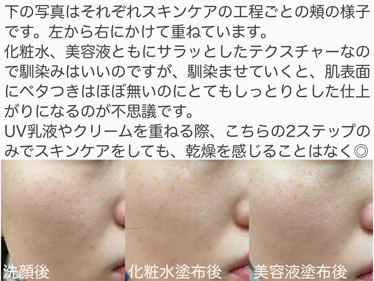 モイストケア ローション MB/d プログラム/化粧水を使ったクチコミ(2枚目)