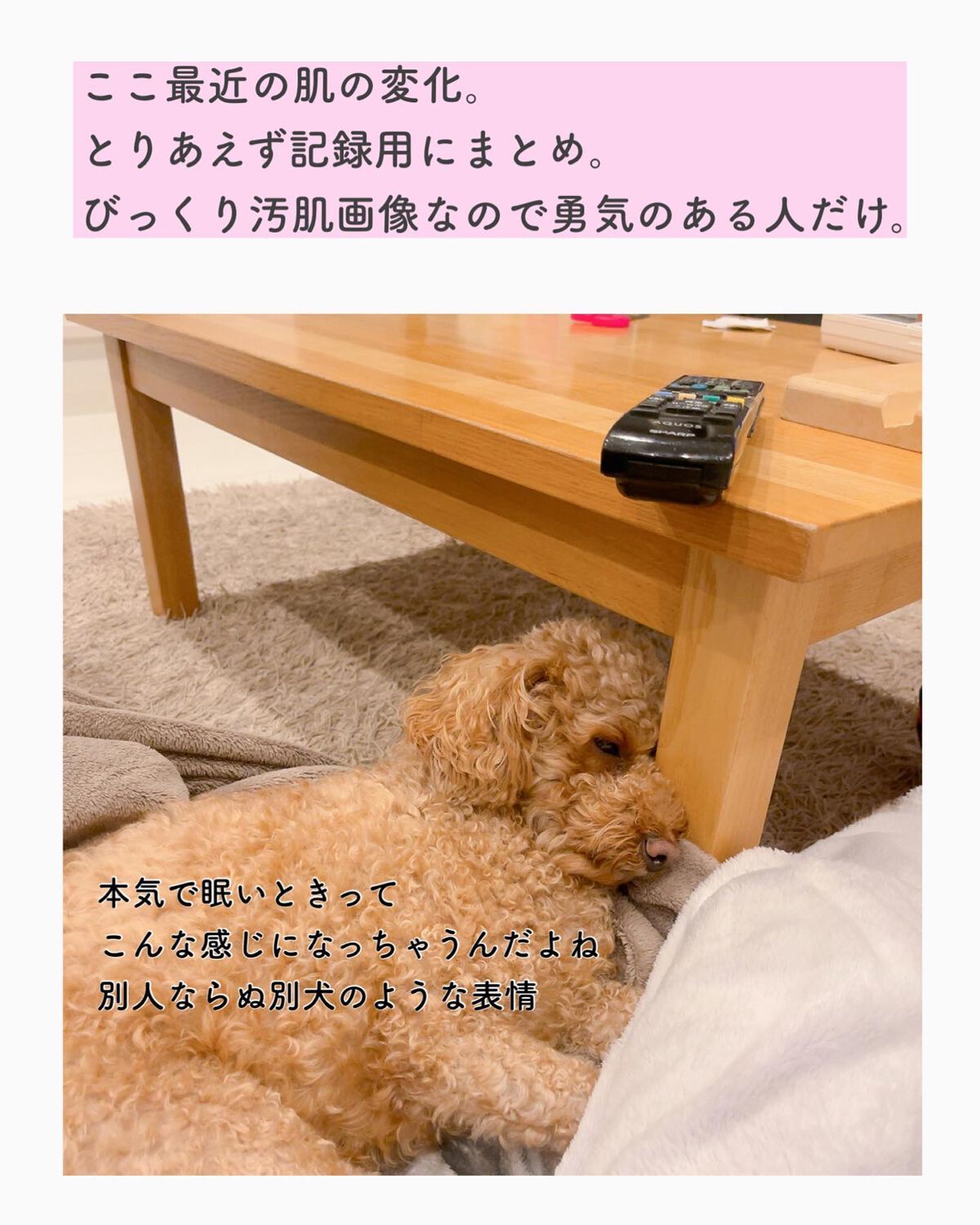 リリーのママ on LIPS 「8月を最後にシミ取り(レーザーではなくほんの少しずつシミを薄く..」(1枚目)