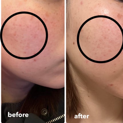 を使ったクチコミ(1枚目)