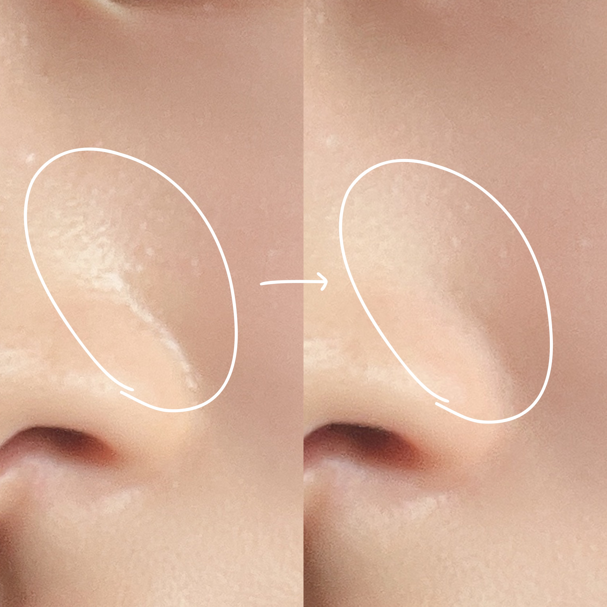 ノーセバムパウダー/Shupong/ルースパウダーを使ったクチコミ（2枚目）